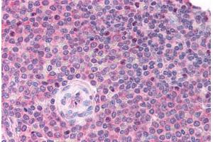 Human Spleen (formalin-fixed, paraffin-embedded) stained with LDB1 antibody ABIN214791 at 5 ug/ml followed by biotinylated goat anti-rabbit IgG secondary antibody ABIN481713, alkaline phosphatase-streptavidin and chromogen. (LIM Domain Binding 1 Protein 抗体  (AA 303-352))