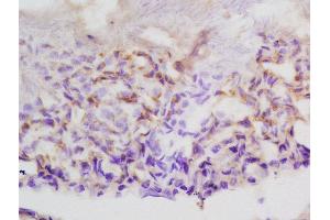 Immunohistochemistry (Paraffin-embedded Sections) (IHC (p)) image for anti-Ankyrin Repeat, SAM and Basic Leucine Zipper Domain Containing 1 (ASZ1) (AA 181-220) antibody (ABIN1387024)