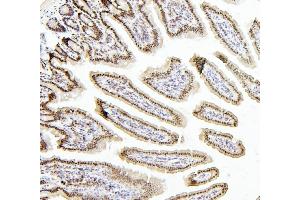 IHC analysis of PTBP1 using anti-PTBP1 antibody (ABIN7599451).