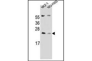 Western blot analysis of LIN7C Antibdy (C-term) in MCF-7, NCI-H292 cell line lysates (35ug/lane). (LIN7C 抗体  (C-Term))