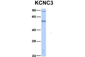 Host:  Rabbit  Target Name:  KCNC3  Sample Type:  Human Fetal Lung  Antibody Dilution:  1. (KCNC3 抗体  (Middle Region))