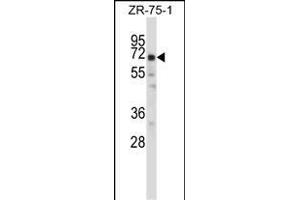 POU2F2 Antibody (N-term) (ABIN657763 and ABIN2846741) western blot analysis in ZR-75-1 cell line lysates (35 μg/lane). (Oct-2 抗体  (N-Term))