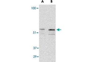 Western blot analysis of PAK2 in Jurkat lysate with PAK2 polyclonal antibody  at (A) 0. (PAK2 抗体  (C-Term))