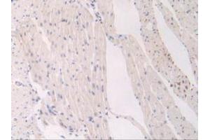 IHC-P analysis of Mouse Heart Tissue, with DAB staining. (FLT1 抗体  (AA 27-329))