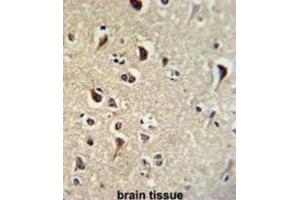 Immunohistochemistry (IHC) image for anti-Kruppel-Like Factor 11 (KLF11) antibody (ABIN3002716) (KLF11 抗体)