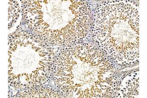 ABIN6257415 and ABIN6275226 at 1/100 staining rat testis tissue by IHC-P. (PGRMC2 抗体  (C-Term))