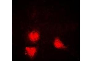Immunofluorescent analysis of SIRT1 staining in Jurkat cells. (SIRT1 抗体)
