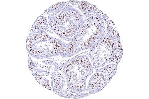 Testis with gradual decrease of 53BP1 staining with maturation of germ cells. (Recombinant TP53BP1 抗体  (C-Term))