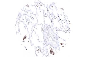 Alveolar macrophages show strong TIM 3 immunostaining (Recombinant TIM3 抗体)