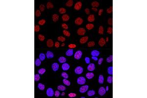 Confocal immunofluorescence analysis of HeLa cells using Histone H2AX Polyclonal Antibody (ABIN6134695, ABIN6141564, ABIN6141567 and ABIN6219268) at dilution of 1:200. (Histone H2A 抗体)