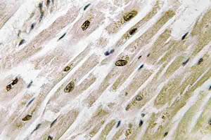 Immunohistochemistry (IHC) analyzes of PAKγ antibody in paraffin-embedded human heart tissue. (PAK2 抗体)