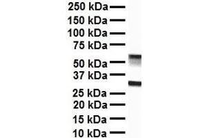 WB Suggested Anti-ZFX antibody Titration: 1 ug/mL Sample Type: Human liver (ZFX 抗体  (C-Term))