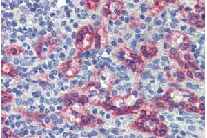 Spleen, Human: Formalin-Fixed, Paraffin-Embedded (FFPE) (ZNF71 抗体  (C-Term))