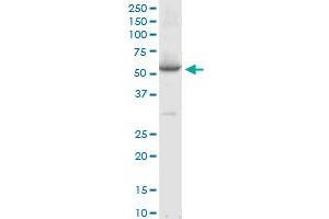 Western Blotting (WB) image for anti-serpin Peptidase Inhibitor, Clade A (Alpha-1 Antiproteinase, Antitrypsin), Member 10 (SERPINA10) (AA 22-444) antibody (ABIN565547)