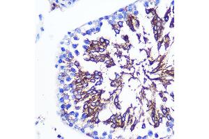 Immunohistochemistry (IHC) image for anti-LETM1 Domain Containing 1 (LETMD1) (AA 161-360) antibody (ABIN3023041)
