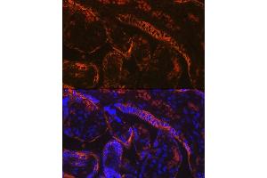 Immunofluorescence analysis of human placenta using Aromatase (CYP19) Rabbit mAb (2238) at dilution of 1:100 (40x lens). (Aromatase 抗体)