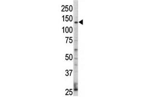 Western blot analysis of ErbB4 / HER4 antibody and HL-60 cell lysate. (ERBB4 抗体  (AA 25-55))