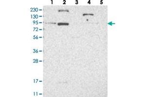 Western blot analysis of Lane 1: RT-4, Lane 2: U-251 MG, Lane 3: Human Plasma, Lane 4: Liver, Lane 5: Tonsil with LCA5 polyclonal antibody . (LCA5 抗体)