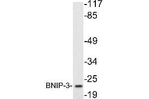 Western blot (WB) analysis of BNIP-3 antibody in extracts from K562cells. (BNIP3 抗体)