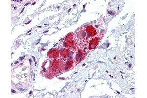 Immunohistochemistry (IHC) image for anti-Transient Receptor Potential Cation Channel, Subfamily V, Member 2 (TRPV2) (AA 595-764) antibody (ABIN574136)