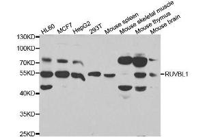 Western blot analysis of extracts of various cell lines, using RUVBL1 antibody. (RUVBL1 抗体  (AA 1-240))
