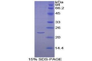 SDS-PAGE analysis of Human KLRC2 Protein. (KLRC2 蛋白)