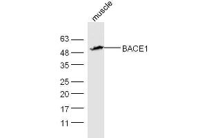 Mouse muscle lysates probed with Rabbit Anti-BACE1 Polyclonal Antibody, Unconjugated  at 1:5000 for 90 min at 37˚C. (BACE1 抗体  (AA 401-501))