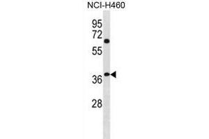 NHLRC3 Antibody (C-term) (ABIN1881580 and ABIN2838947) western blot analysis in NCI- cell line lysates (35 μg/lane). (NHLRC3 抗体  (C-Term))