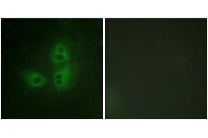 Immunofluorescence analysis of HeLa cells, using nNOS (Ab-852) Antibody. (NOS1 抗体  (AA 818-867))