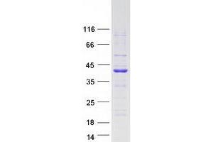 Western Blotting (WB) image for PDZ and LIM Domain 4 (PDLIM4) (Transcript Variant 1) protein (Myc-DYKDDDDK Tag) (ABIN2728591)