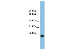 WB Suggested Anti-TGFB2 Antibody Titration: 0. (TGFB2 抗体  (Middle Region))