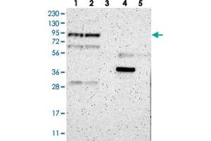 Western blot analysis of Lane 1: RT-4, Lane 2: U-251 MG, Lane 3: Human Plasma, Lane 4: Liver, Lane 5: Tonsil with LEPREL1 polyclonal antibody . (LEPREL1 抗体)