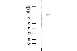 Western blot analysis of lysates from Rat brain, using FER Antibody at 1/1000 dilution.