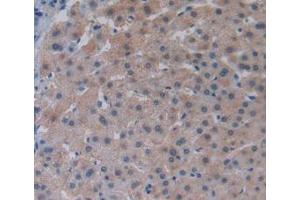 Figure. (LPCAT3 抗体  (AA 122-233))