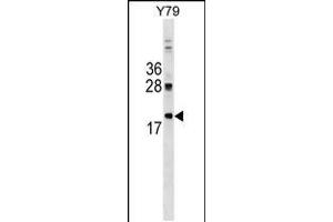 Western blot analysis in Y79 cell line lysates (35ug/lane). (DNAJC5 抗体  (AA 52-80))