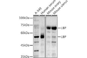 Western blot analysis of extracts of various cell lines, using LBP antibody (ABIN7268285) at 1:1000 dilution. (LBP 抗体)