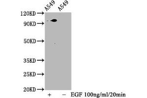 Western Blotting (WB) image for anti-Signal Transducer and Activator of Transcription 3 (Acute-Phase Response Factor) (STAT3) (pSer727) antibody (ABIN7127754)