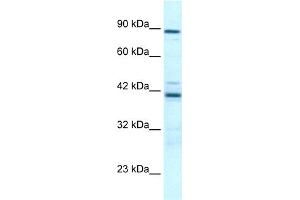 WB Suggested Anti-TBX5 Antibody Titration:  0. (T-Box 5 抗体  (Middle Region))