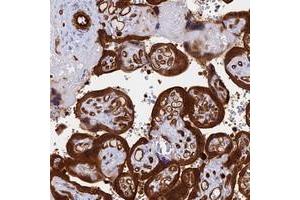 Immunohistochemical staining of human placenta with CRIP2 polyclonal antibody  shows strong cytoplasmic and membranous positivity in trophoblastic cells at 1:500-1:1000 dilution. (CRIP2 抗体)