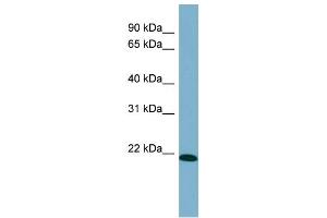 WB Suggested Anti-TIRAP Antibody Titration: 0. (TIRAP 抗体  (Middle Region))