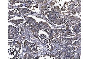 IHC analysis of ERAP2 using anti-ERAP2 antibody (ABIN7599949). (ERAP2 抗体  (AA 13-960))