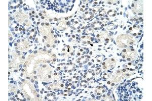 SSB antibody was used for immunohistochemistry at a concentration of 4-8 ug/ml to stain Epithelial cells of renal tubule (arrows) in Human Kidney. (SSB 抗体)