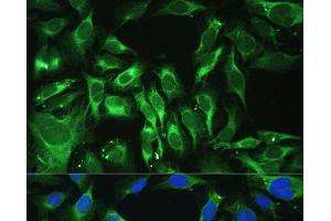 Immunofluorescence analysis of U-2 OS cells using OGN Polyclonal Antibody at dilution of 1:100. (OGN 抗体)