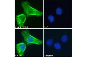 ABIN570800 Immunofluorescence analysis of paraformaldehyde fixed A431 cells, permeabilized with 0. (SLCO1B3 抗体  (Internal Region))
