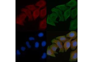 ABIN6258556 and ABIN6275402 staining Hela cells by IF/ICC. (POTEB 抗体  (C-Term))