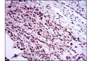 Image no. 2 for anti-E2F Transcription Factor 1 (E2F1) antibody (ABIN1491636) (E2F1 抗体)