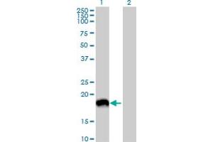 Western Blot analysis of MAP1LC3A expression in transfected 293T cell line by MAP1LC3A MaxPab polyclonal antibody. (MAP1LC3A 抗体  (AA 1-121))