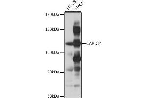Western blot analysis of extracts of various cell lines, using C antibody (ABIN7266126) at 1:1000 dilution. (CARD14 抗体  (AA 200-500))