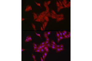 Immunofluorescence (IF) image for anti-RanBP-Type and C3HC4-Type Zinc Finger Containing 1 (RBCK1) antibody (ABIN7269848)
