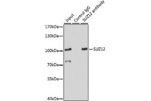 Immunoprecipitation analysis of 200 μg extracts of HeLa cells using 3 μg SUZ12 antibody (ABIN6127300, ABIN6148752, ABIN6148754 and ABIN7101816).